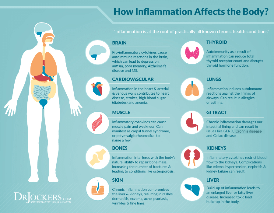 Inflammation-diagram